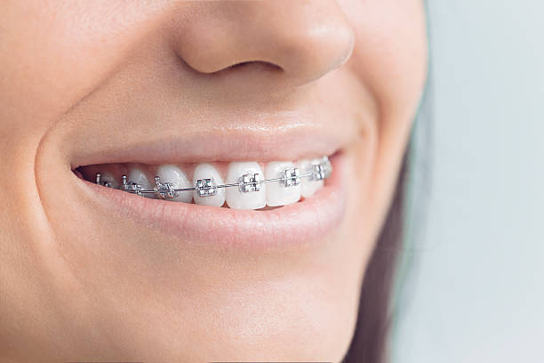 Best Teeth Whitening  in Omak, WA